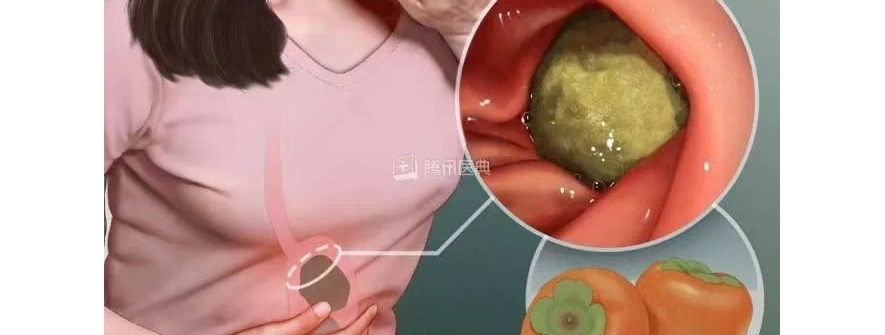 今日科普！山楂柿子正当时，“秋冬限定组合”食用需谨慎！