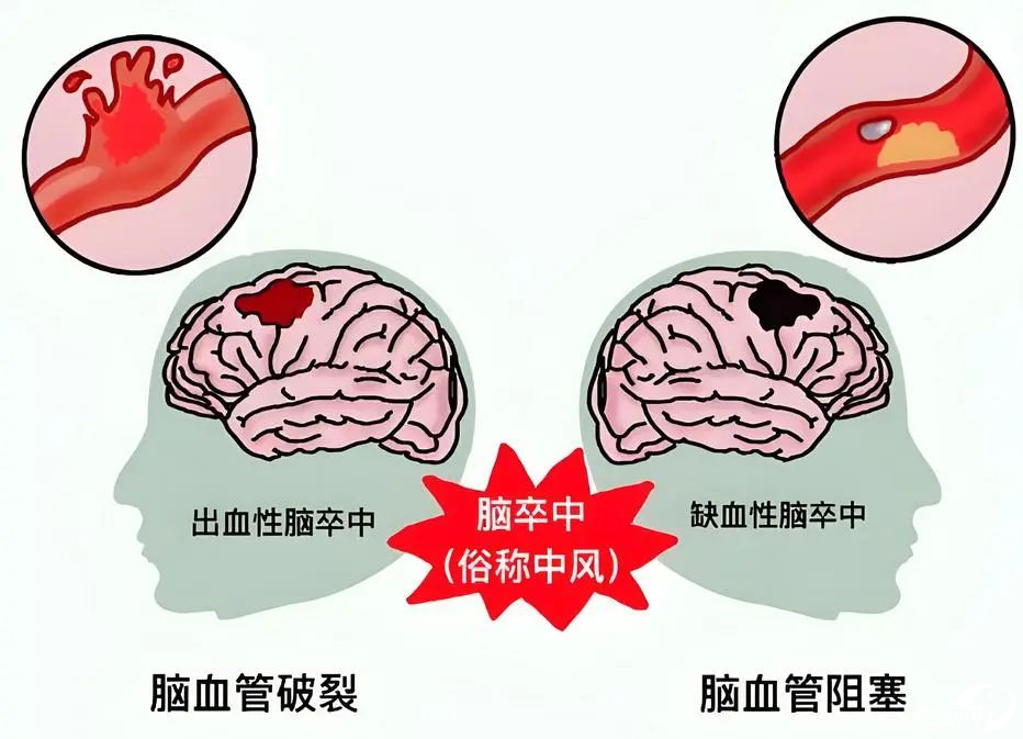 105852gasu4w55zf36ye55.png